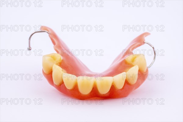 Removable denture of an upper jaw, denture, dental prosthesis, dentist