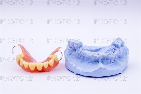 Removable denture of an upper jaw, denture, denture, dentist, dental impression
