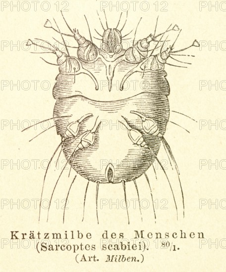 Historical wood engraving, illustration from Meyers encyclopedia 4th edition 1889 and 1890, scabies
