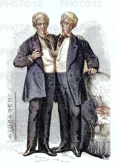 Chang and Eng Bunker, 11 May 1811, 17 January 1874, were conjoined twins who gave their name to