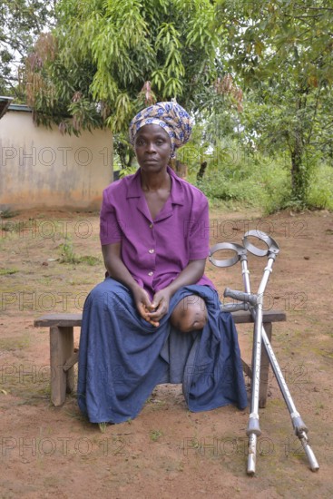 Amputee, Motema Amputee Camp, Koidu, Koidu-Sefadu, Kono District, Eastern Province, Sierra Leone,