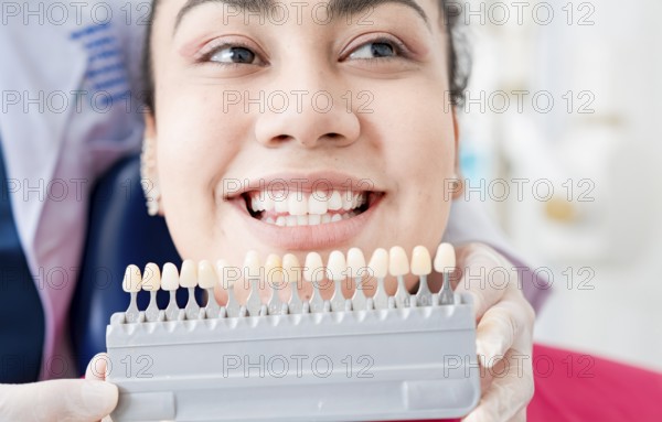 Dentist holding a set of implants with various shades of tone. Patient selecting the shade of