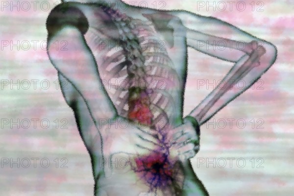 Back pain is a common condition and is particularly caused by sedentary behaviour