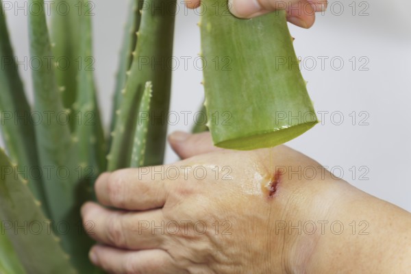 Close-up of a woman applying fresh aloe vera to a wound on her hand