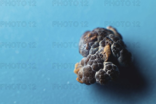 Kidney stone, intact, formed in an alkaline environment in the kidneys after ESWL intervention or