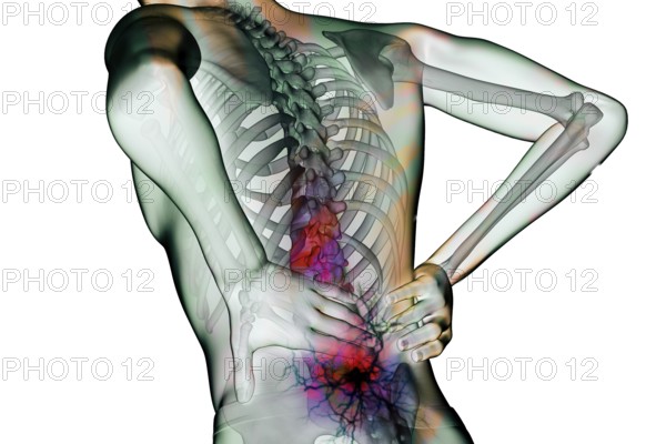 Back pain is a common condition and is particularly caused by sedentary behaviour