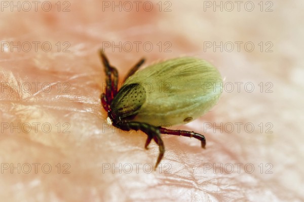 Tick bitten into human skin, common Castor Bean Tick (Ixodes ricinus), tick bite