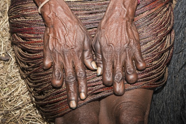 Hands of Dani woman, amputated finger, tradition on death of close relative, Baliem Valley, West