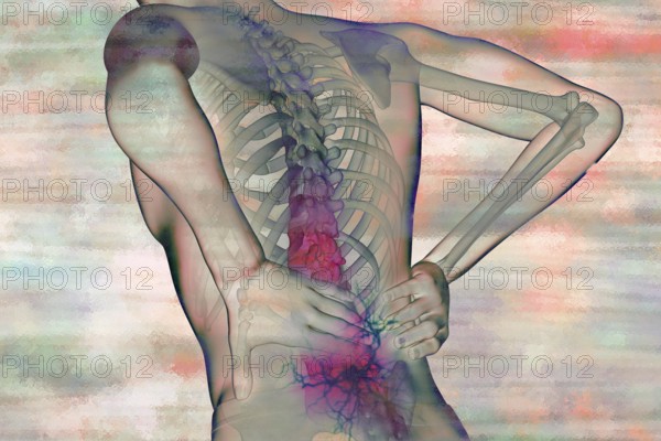 Back pain is a common condition and is particularly caused by sedentary behaviour
