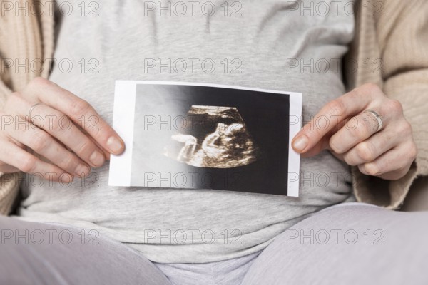 Close up pregnant woman with ultrasound image
