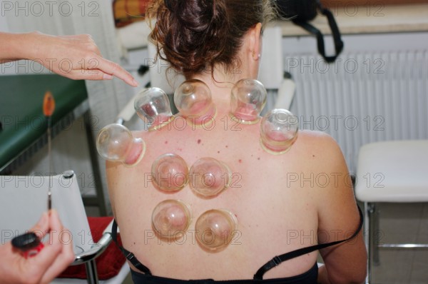 Woman gets fleeced, cupped, cupped balls