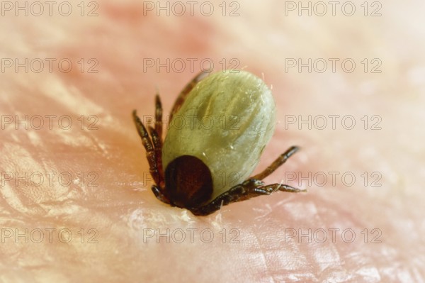 Tick bitten into human skin, common Castor Bean Tick (Ixodes ricinus), tick bite