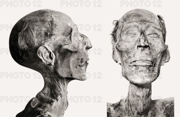 Mummy of Ramses II
