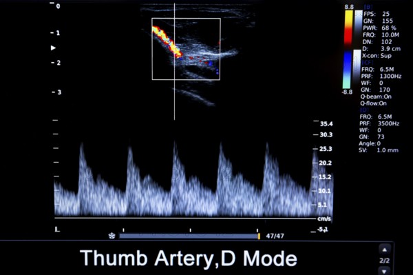 Colourful image of modern ultrasound monitor. Ultrasonography machine. High technology medical and