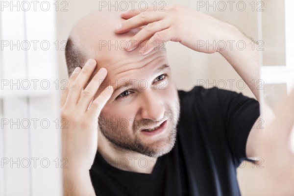 Male alopecia or hair loss concept, adult caucasian bald man looking mirror for head baldness