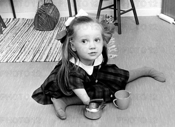 Thalidomide scandal. In the late 1950s and early 1960s, the use of thalidomide in 46 countries by