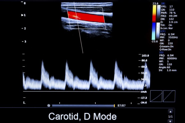 Colourful image of modern ultrasound monitor. Ultrasonography machine. High technology medical and
