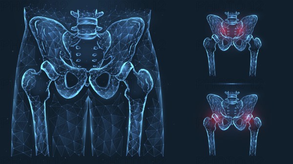 Bones of the pelvis and hip, human anatomy. Pelvic and hip injuries. X ray of the hip joint made of