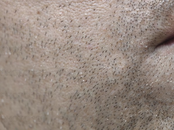 The skin of the man's face with stubble and flaky skin, sparse, gray hairs in the beard. Karaganda,