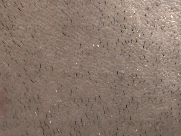 The skin of man's face with stubble and flaky skin, sparse gray hairs in the beard, Karaganda,