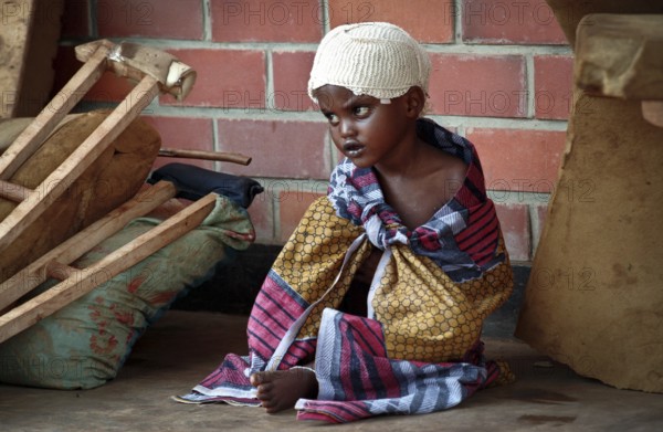 RWA Rwanda Kigali Injured Tutsi refugee children receive medical care in a makeshift hospital by