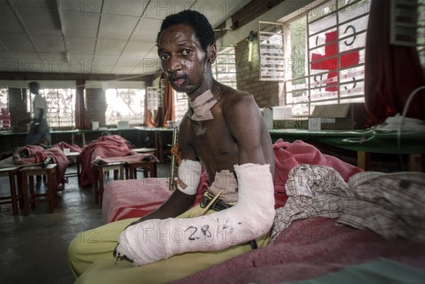 RWA Rwanda Kigali Injured Tutsi refugee receives medical care in a makeshift hospital by doctors
