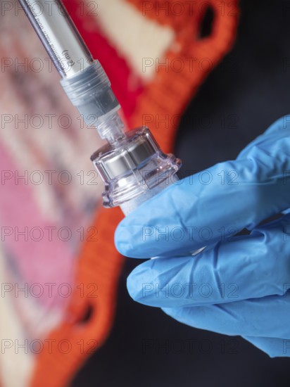 Istambul, Turkey October 21st 2025 Nurse hand in blue glove holding Sandostatin injection,