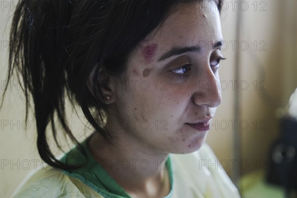 Wounded individuals receiving treatment at a hospital after being evacuated with difficulty from
