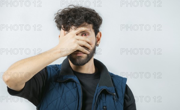 Person with eye infection looking at camera. Close up of man with red eyes suffering from