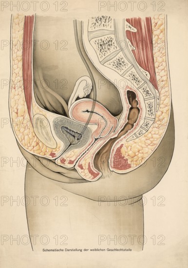 Medical illustration, clinical picture, venereal disease, schematic representation of female
