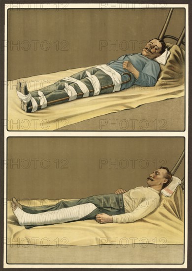 First aid, emergency treatment for broken bones, school picture, authentic reproduction of a school