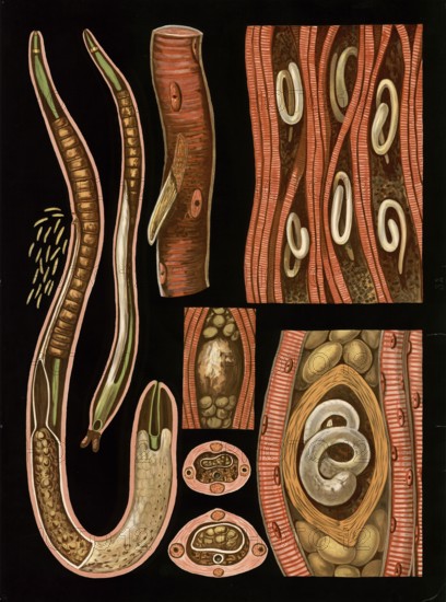Scientific illustration with details, nematode, trichinella spiralis, school picture, authentic