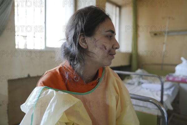 Wounded individuals receiving treatment at a hospital after being evacuated with difficulty from
