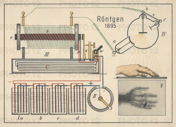The illustration shows the first X-ray image of a human hand, which was taken by Wilhelm Conrad