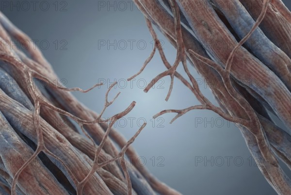 Microscopic view of the fine capillaries of the heart muscle showing the loss of small blood