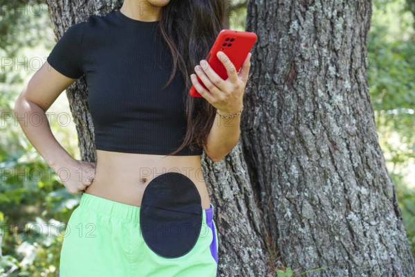 A woman with a visible ostomy stands outdoors, leaning against a tree, holding a red smartphone She