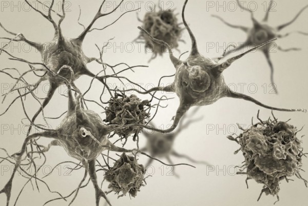 Macro-cross section of degenerating nerve cells with visible protein deposits to visualize