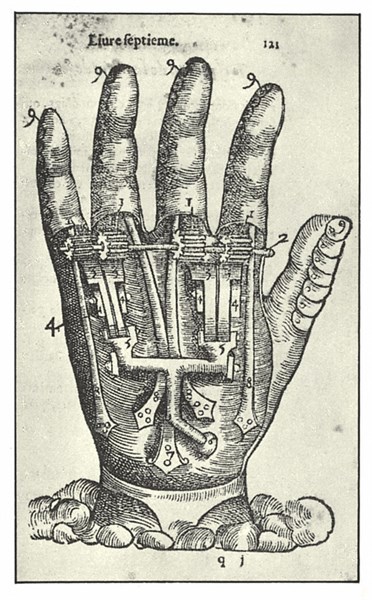 Artificial hand by Ambroise Paré