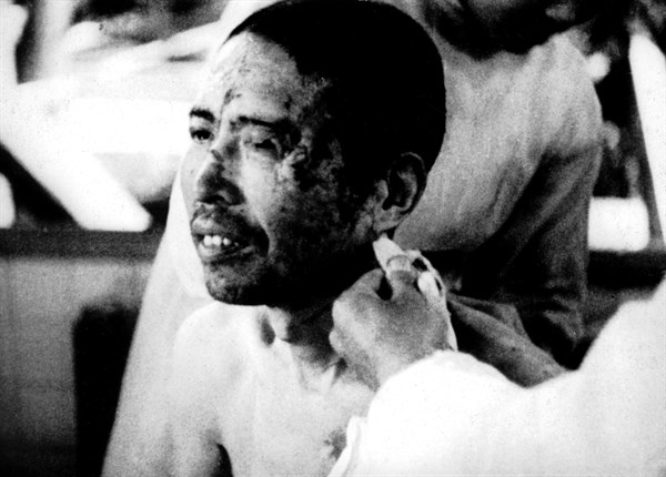 Hiroshima: Victim of the atomic bomb