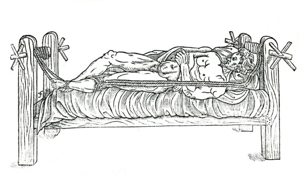 Apparatus for reducing dislocations, 1544. Artist: Unknown