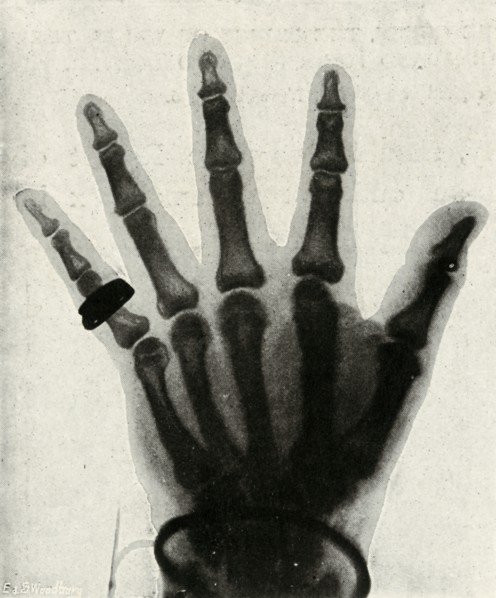 'Radiograph of the Hand of H.R.H. The Prince of Wales', (c1897). Artist: Unknown.