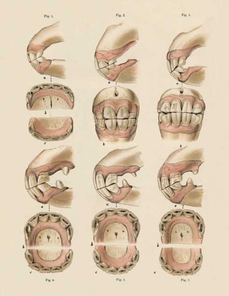 Description of Plate Showing the Age, As Indicated By The Teeth', c1879.