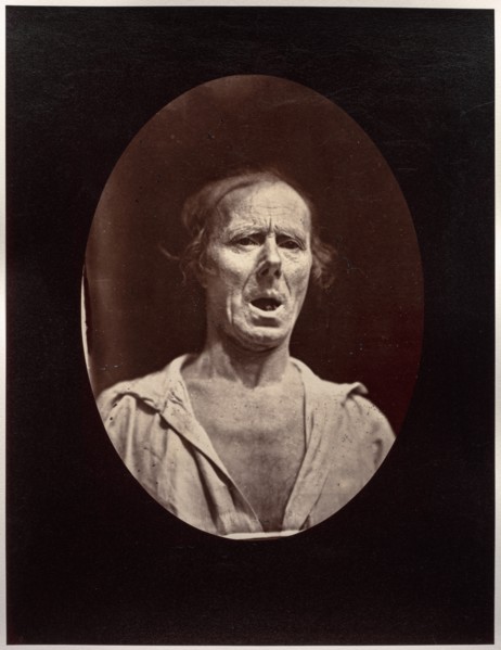Figure 54: Abaissement volontaire de la mâchoire inférieure: mouvement inexpressif, c. 1856. Creator: Guillaume-Benjamin-Amand Duchenne (de Boulogne) (French, 1806-1875); Adrien Tournachon (French, 18...