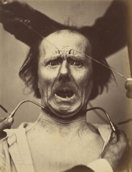 Icono-photographique. Mécanisme de la Physionomie Humaine. Fig. 65, 1854-56, printed 1862.
