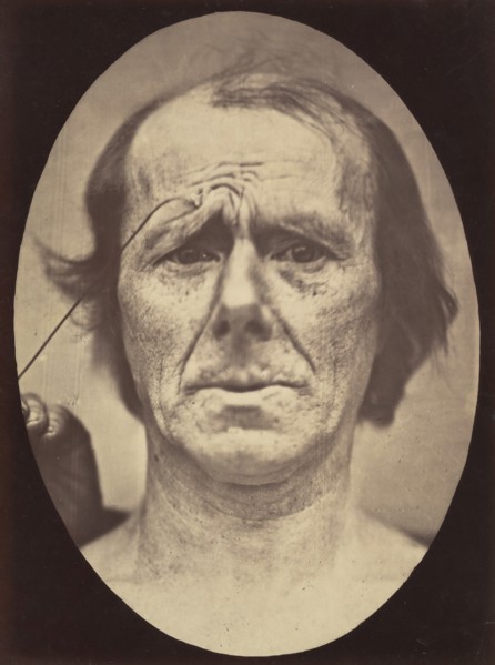 Figure 19: Suffering , 1854-56, printed 1862.
