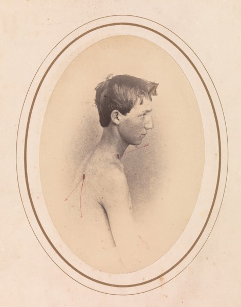 Private Jacob F. Simmons, Company H, Eighty-second Pennsylvania Volunteers, April-May 1865.