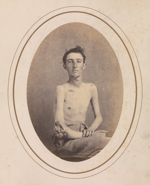 Private James H. Stokes, Company H, 185th New York Volunteers, April-May 1865.