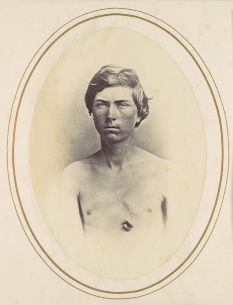 Frederick A. Bentley, 1865.