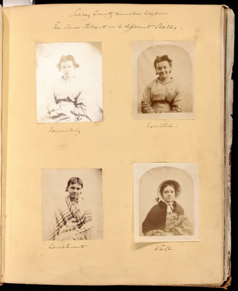 Untitled [Surrey County Lunatic Asylum - the Same Patient in 4 different States], 1849/60.  Creator: Hugh Welch Diamond.
