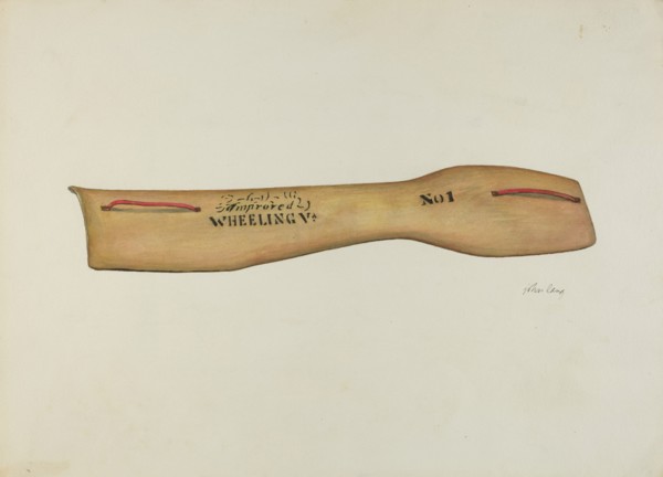 Improved Splint, c. 1940.